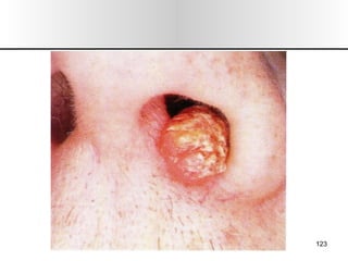 Nariz y senos paranasales