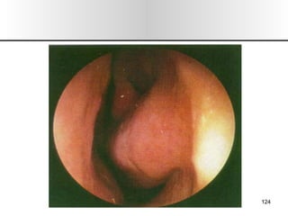 Nariz y senos paranasales