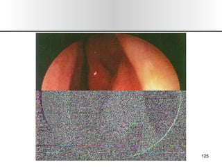 Nariz y senos paranasales