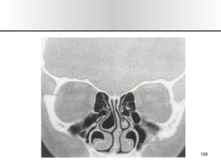 Nariz y senos paranasales