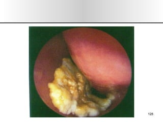 Nariz y senos paranasales