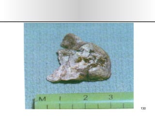 Nariz y senos paranasales