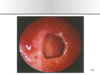 Nariz y senos paranasales