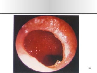 Nariz y senos paranasales