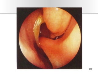 Nariz y senos paranasales