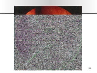 Nariz y senos paranasales