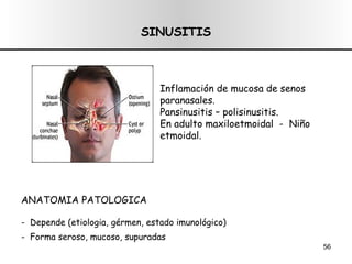 SINUSITIS ANATOMIA PATOLOGICA -  Depende (etiologia, gérmen, estado imunológico) -  Forma seroso, mucoso, supuradas Inflamación de mucosa de senos paranasales. Pansinusitis – polisinusitis. En adulto maxiloetmoidal  -  Niño etmoidal. 