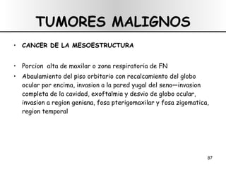TUMORES MALIGNOS CANCER DE LA MESOESTRUCTURA Porcion  alta de maxilar o zona respiratoria de FN Abaulamiento del piso orbitario con recalcamiento del globo ocular por encima, invasion a la pared yugal del seno—invasion completa de la cavidad, exoftalmia y desvio de globo ocular, invasion a region geniana, fosa pterigomaxilar y fosa zigomatica, region temporal 