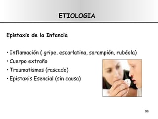 ETIOLOGIA Epistaxis de la Infancia Inflamación ( gripe, escarlatina, sarampión, rubéola) Cuerpo extraño  Traumatismos (rascado) Epistaxis Esencial (sin causa) 