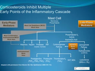 Plateau IrisWhen indentation gonioscopy is performed, the double-hump sign is seen.The more peripheral hump is determined by the ciliary body propping up the iris root, and the more central hump represents the central third of the iris resting over the anterior lens surface.The space between the humps represents the space between the ciliary processes and the endpoint of contact of the iris to the anterior lens capsule.More force often is needed to open the angle on indentation gonioscopy than on pupillary block angle closure.