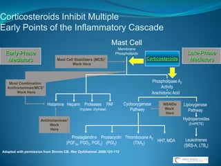 Plateau IrisPlateau iris syndrome is characterized by persistent angle occludability (spontaneous, in the dark, or after dilation) in an eye with a patent iridotomyMore commonly, the diagnosis of plateau iris configuration is made on routine examination.Plateau iris syndrome usually is recognized in the postoperative period when the angle remains persistently narrow in an eye after iridotomy