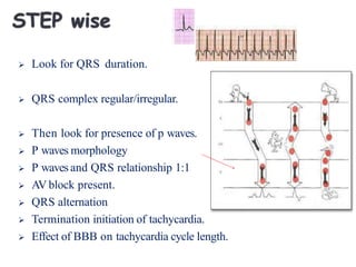  Look for QRS duration.
 QRS complex regular/irregular.
 Then look for presence of p waves.
 P waves morphology
 P waves and QRS relationship 1:1
 AV block present.
 QRS alternation
 Termination initiation of tachycardia.
 Effect of BBB on tachycardia cycle length.
 