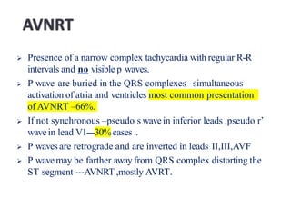  Presence of a narrow complex tachycardia with regular R-R
intervals and no visible p waves.
 P wave are buried in the QRS complexes –simultaneous
activation of atria and ventricles most common presentation
of AVNRT –66%.
 If not synchronous –pseudo s wavein inferior leads ,pseudo r’
wavein lead V1---30%cases .
 P waves are retrograde and are inverted in leads II,III,AVF
 P wavemay be farther awayfrom QRS complex distorting the
ST segment ---AVNRT ,mostly AVRT.
 