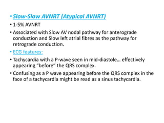 •Slow-Slow AVNRT (Atypical AVNRT)
• 1-5% AVNRT
• Associated with Slow AV nodal pathway for anterograde
conduction and Slow left atrial fibres as the pathway for
retrograde conduction.
• ECG features:
• Tachycardia with a P-wave seen in mid-diastole… effectively
appearing “before” the QRS complex.
• Confusing as a P wave appearing before the QRS complex in the
face of a tachycardia might be read as a sinus tachycardia.
 