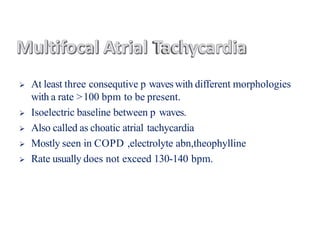  At least three consequtive p waves with different morphologies
with a rate >100 bpm to be present.
 Isoelectric baseline between p waves.
 Also called as choatic atrial tachycardia
 Mostly seen in COPD ,electrolyte abn,theophylline
 Rate usually does not exceed 130-140 bpm.
 