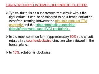 CAVO-TRICUSPID ISTHMUS DEPENDENT FLUTTER.
Typical flutter is as a macroreentrant circuit within the
right atrium. It can be considered to be a broad activation
wavefront rotating between the tricuspid annulus (TA)
anteriorly and the crista terminalis-eustachian
ridge/inferior vena cava (IVC) posteriorly .
In the most common form (approximately 90%) the circuit
rotates in a counterclockwise direction when viewed in the
frontal plane.
In 10%, rotation is clockwise.
 