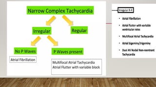 Approach to diagnosis of narrow complex tachycardia | PPTX