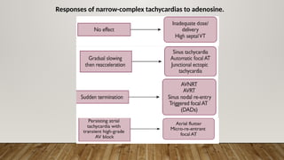 Approach to diagnosis of narrow complex tachycardia | PPTX