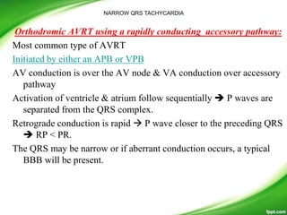 Pathway Apb Narrow qrs tachy i.tammi raju | PPTX
