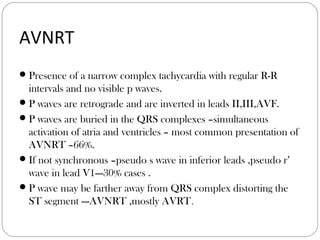 AVNRT
Presence of a narrow complex tachycardia with regular R-R
intervals and no visible p waves.
P waves are retrograde and are inverted in leads II,III,AVF.
P waves are buried in the QRS complexes –simultaneous
activation of atria and ventricles – most common presentation of
AVNRT –66%.
If not synchronous –pseudo s wave in inferior leads ,pseudo r’
wave in lead V1---30% cases .
P wave may be farther away from QRS complex distorting the
ST segment ---AVNRT ,mostly AVRT.
 