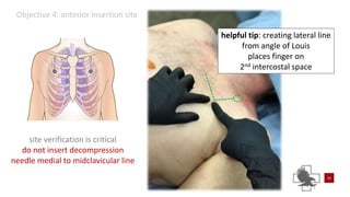 Power point of needle chest compressions | PPTX
