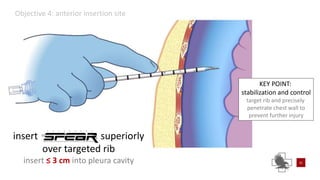 Power point of needle chest compressions | PPTX