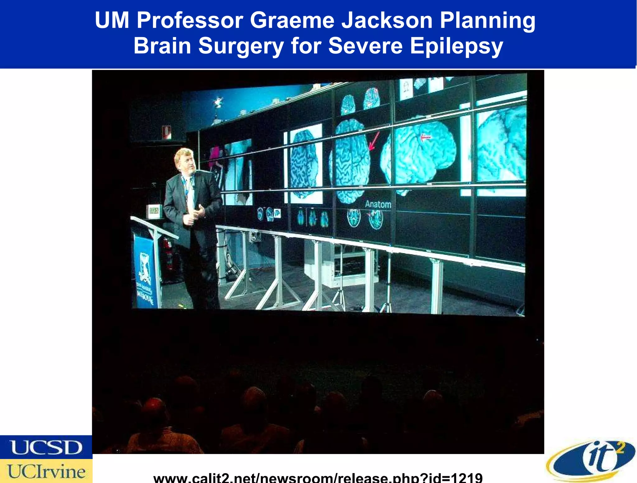 UM Professor Graeme Jackson Planning  Brain Surgery for Severe Epilepsy www.calit2.net/newsroom/release.php?id=1219 