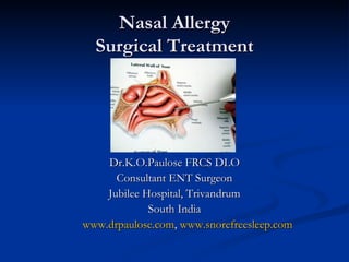 Nasal Allergy
  Surgical Treatment




    Dr.K.O.Paulose FRCS DLO
      Consultant ENT Surgeon
    Jubilee Hospital, Trivandrum
             South India
www.drpaulose.com, www.snorefreesleep.com
 