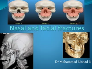 Dr Mohammed Nishad N
 