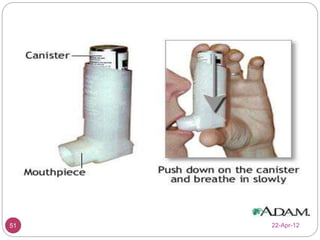 Nasal and pulmonary dds | PPTX