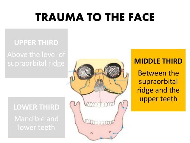 NASAL BONE FRACTURE