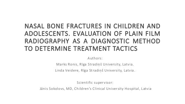 Nasal bone fractures in children and adolescents ...