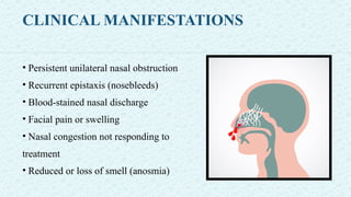 CLINICAL MANIFESTATIONS
• Persistent unilateral nasal obstruction
• Recurrent epistaxis (nosebleeds)
• Blood-stained nasal discharge
• Facial pain or swelling
• Nasal congestion not responding to
treatment
• Reduced or loss of smell (anosmia)
 