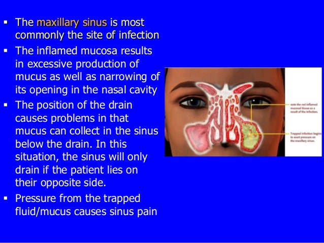 Nasal cavity