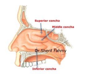 Superior concha
Middle concha
Inferior concha
Dr.Sherif Fahmy
 