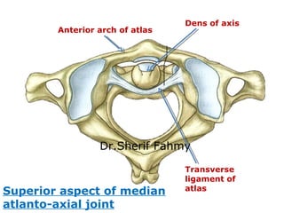 Transverse
ligament of
atlas
Dens of axis
Superior aspect of median
atlanto-axial joint
Anterior arch of atlas
Dr.Sherif F...