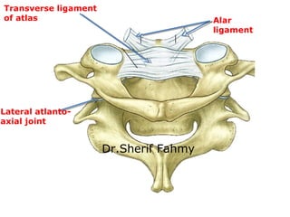 Transverse ligament
of atlas Alar
ligament
Lateral atlanto-
axial joint
Dr.Sherif Fahmy
 