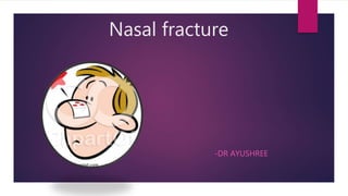 Nasal fracture
-DR AYUSHREE
 