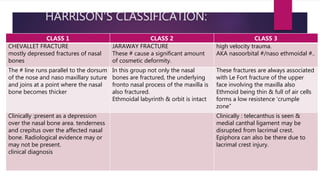 Nasal fracture ent ppt | PPTX
