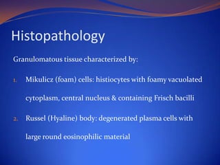 Histopathology
Granulomatous tissue characterized by:
1.

Mikulicz (foam) cells: histiocytes with foamy vacuolated

cytoplasm, central nucleus & containing Frisch bacilli
2.

Russel (Hyaline) body: degenerated plasma cells with

large round eosinophilic material

 