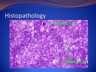 Histopathology

 