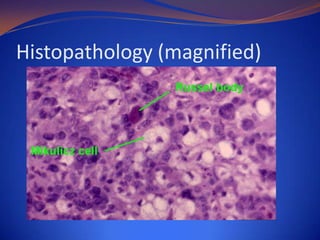Histopathology (magnified)

 