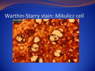 Warthin-Starry stain: Mikulicz cell

 