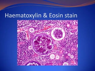 Haematoxylin & Eosin stain

 