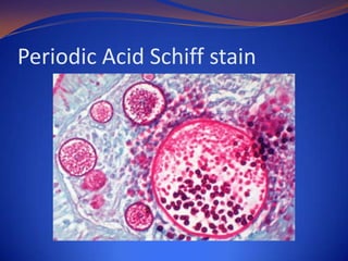 Periodic Acid Schiff stain

 