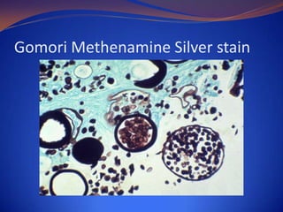 Gomori Methenamine Silver stain

 