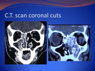C.T. scan coronal cuts

 