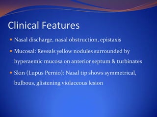 Clinical Features
 Nasal discharge, nasal obstruction, epistaxis
 Mucosal: Reveals yellow nodules surrounded by

hyperaemic mucosa on anterior septum & turbinates
 Skin (Lupus Pernio): Nasal tip shows symmetrical,

bulbous, glistening violaceous lesion

 