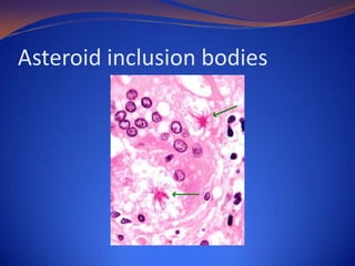Asteroid inclusion bodies

 