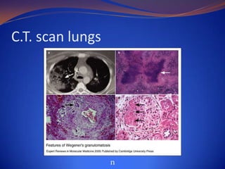 C.T. scan lungs

n

 